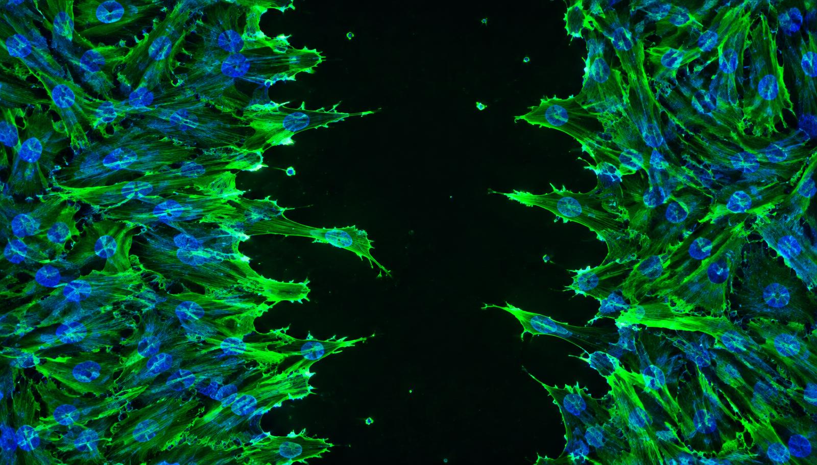 Fluorescence microscopy of cells with green actin filaments migrating into a scratch wound gap